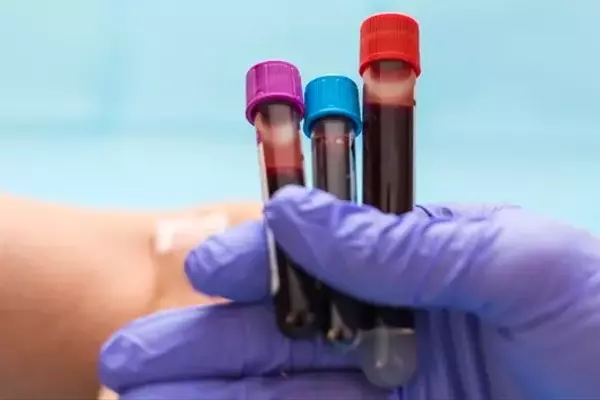 Guardant Health: High Growth, High Valuation, Uncertain Future